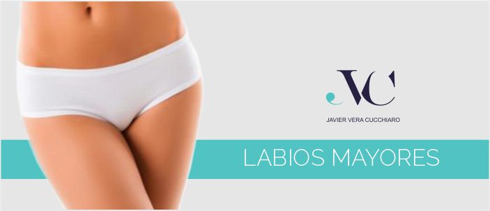 imagen labiosmayores