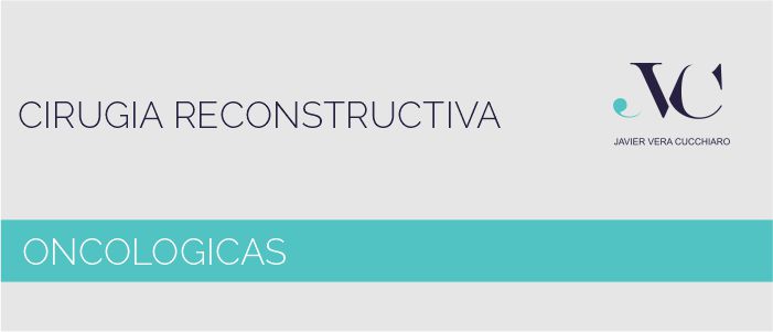 imagen oncologica